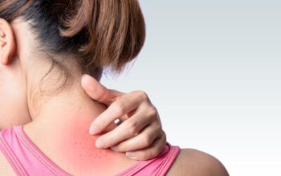 Simple Solutions for Itchy Skin
