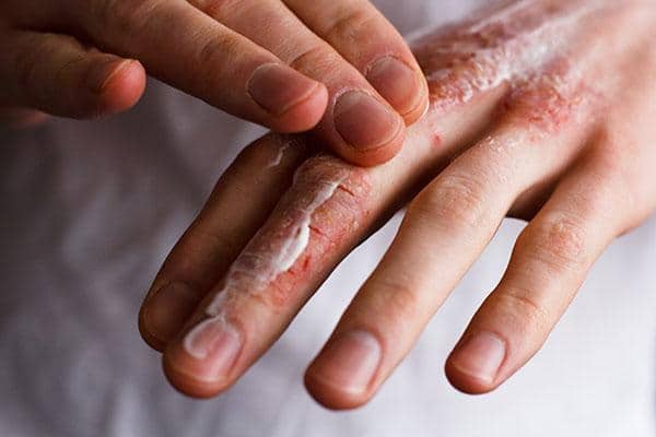 itchy skin causes