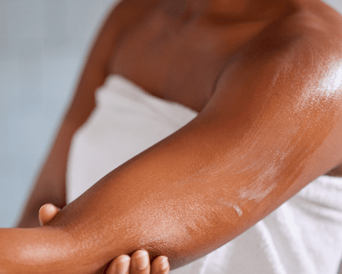How to Prevent and Treat Dry Skin
