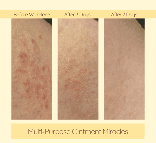 Multi-Purpose Ointment - Value Pack