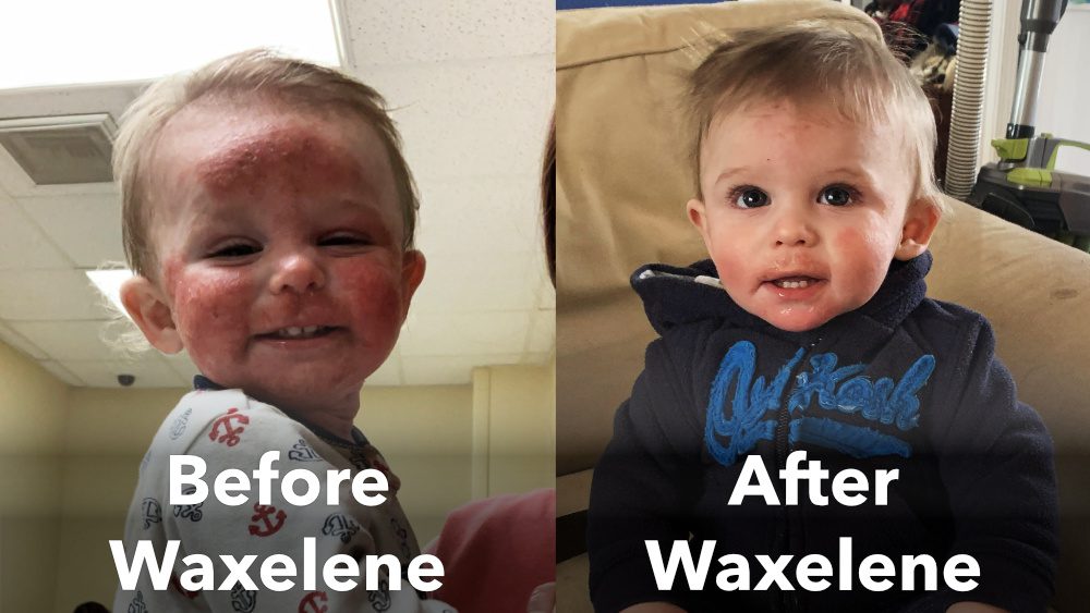 Waxelene faces off with Vaseline, and wins - Truth In Aging