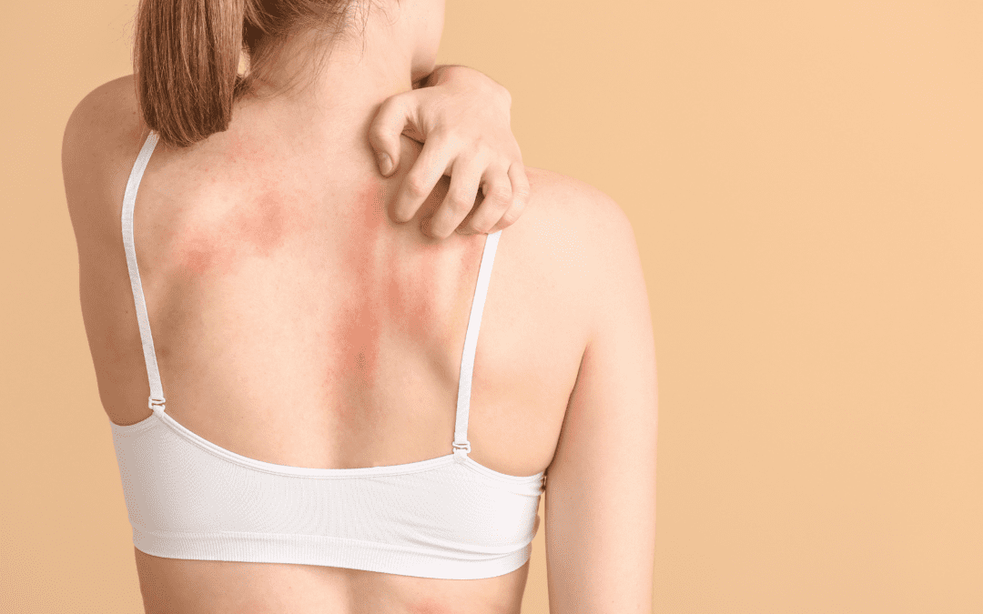 Simple Solutions for Itchy Skin
