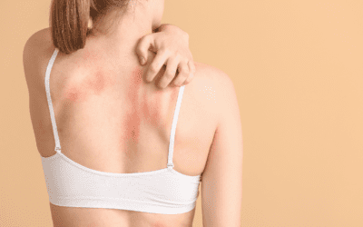 Simple Solutions for Itchy Skin