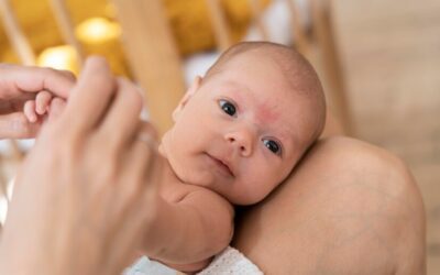 Top 3 dry skin causes for babies (Plus solutions!)